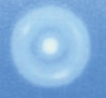 Image: Thermochromic tile image obtained from a “hot-spot” treatment head, 10 seconds after completionof the exposure. Whiteness indicates hot areas (Photo courtesy of NPL, UK). Image: Thermochromic tile image obtained from a “hot-spot” treatment head, 10 seconds after completionof the exposure. Whiteness indicates hot areas (Photo courtesy of NPL, UK).